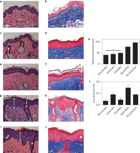 Histology of dorsal mouse skin sections receiving different topical ...