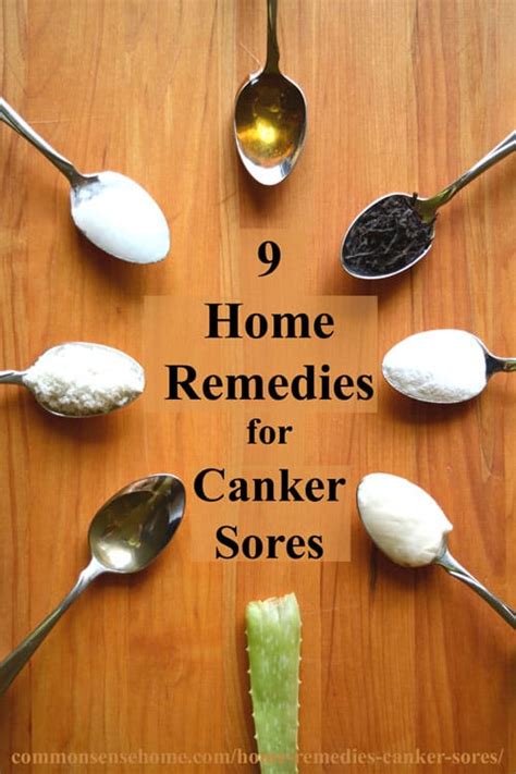 9 Home Remedies for Canker Sores & Tips to Avoid Canker Sore Triggers