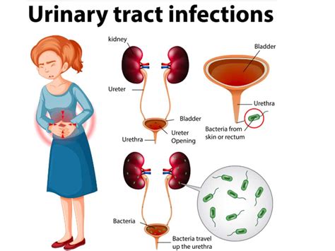 Suffering From UTI? Home Remedies By Rujuta Diweka May Help Relieve ...