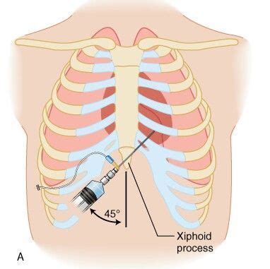 Pin en Cardiovascular System