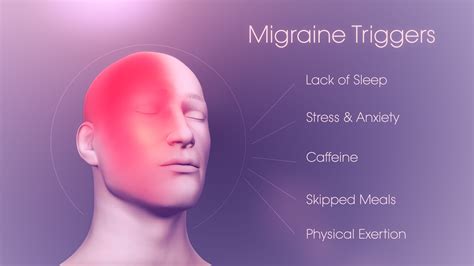 Migraine