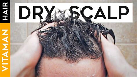 How To Prevent A Dry Scalp - Longfamily26