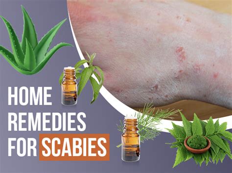 What Are Causes Of Scabies Symptoms Treatment And Home Remedies ...