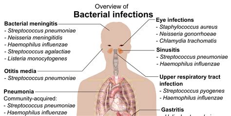 Overview of the Bacterial Infections Chart - NCLEX Quiz