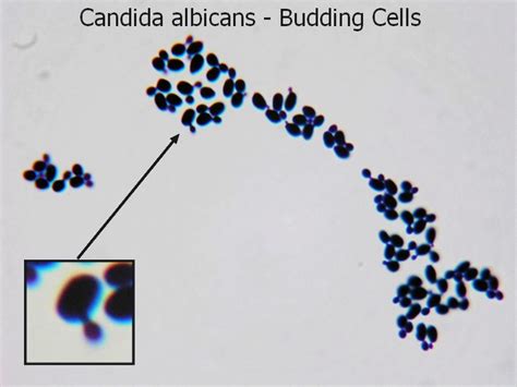 Fun With Microbiology (What's Buggin' You?): Candida albicans