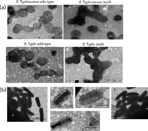 Separation of the murein sacculus during cell division is not affected ...