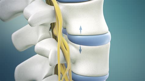 Non Surgical Spinal Decompression Physiotherapists In Toronto