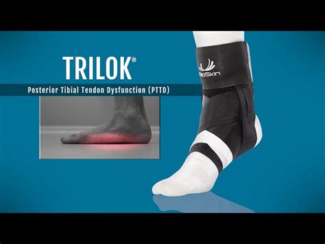 Posterior Tibial Tendonitis Brace