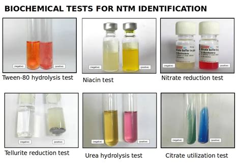 Urea Hydrolysis Test