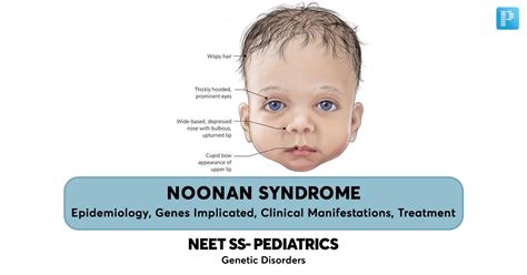 Noonan Syndrome Epidemiology Genes Implicated