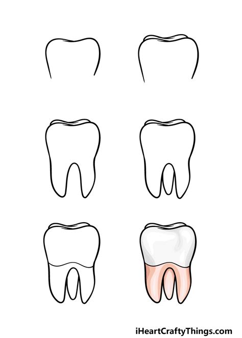 Easy Drawing Of A Dentist Easy Drawing Of A Tooth Palmer Brev2001