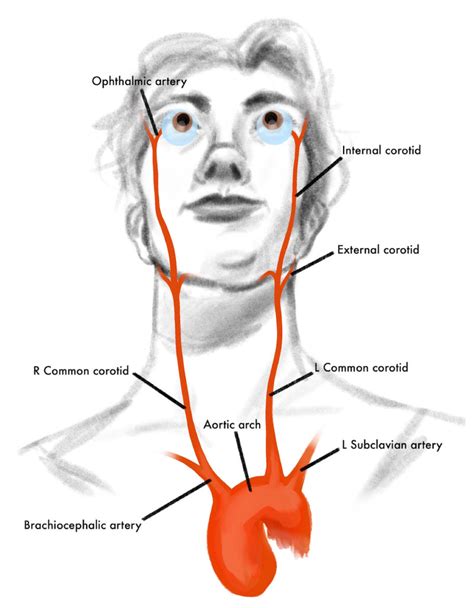 Ocular Ischemic Syndrome