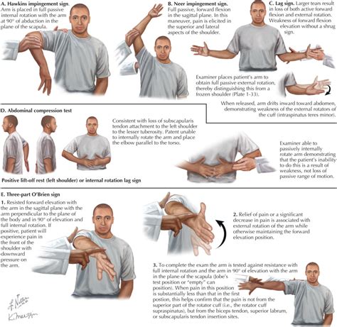 Shoulder Injuries Musculoskeletal Key