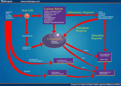 Sepsis Pathophysiology Diagram