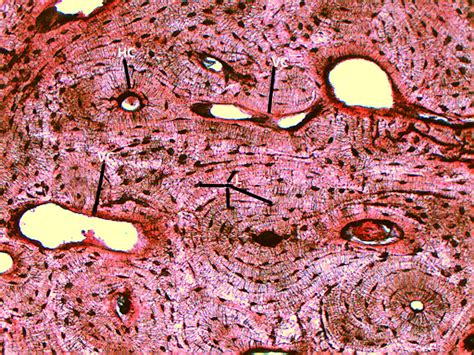 Compact Bone X Histology