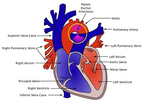 Ductus Arteriosus