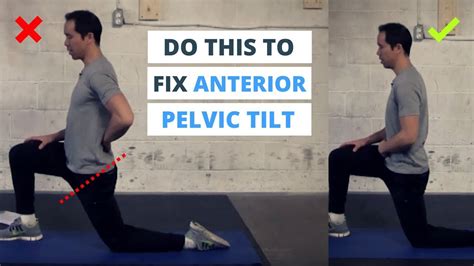 6 Minute Routine To Correct Anterior Pelvic Tilt Youtube