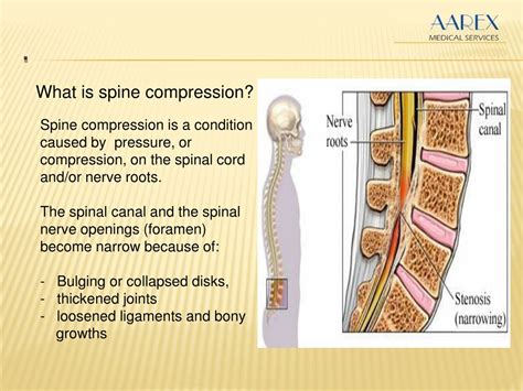 Ppt Spine Decompression Surgery Powerpoint Presentation Free