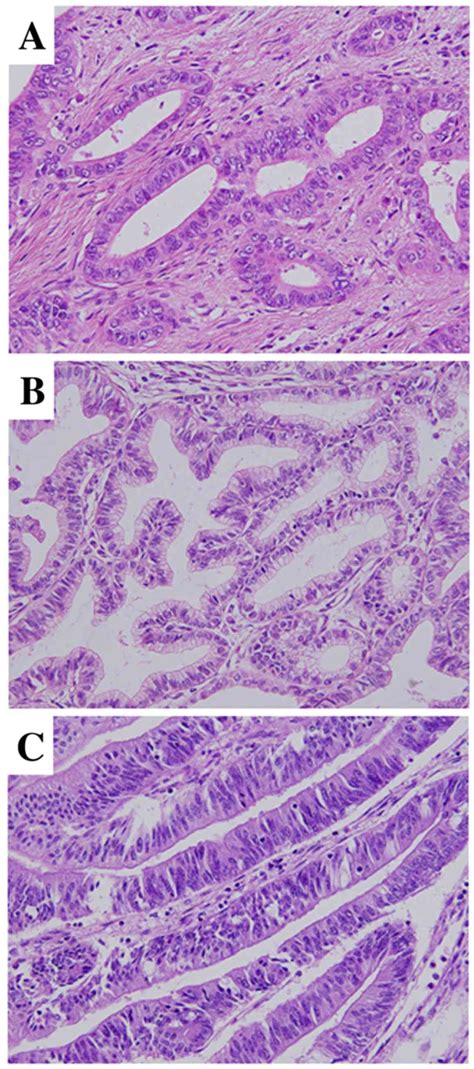 Common Bile Duct Histology