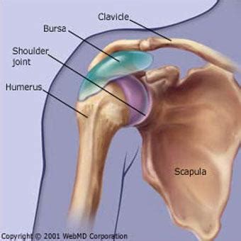 What Is Shoulder Bursitis Dr Roger Chams