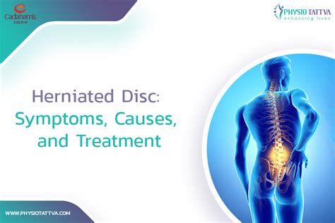 Herniated Disc Symptoms Causes Treatments And Prevention