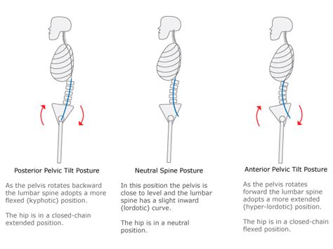 Pelvic Tilt Exercise Tract Gray Chiropractic Stcatharines Spine