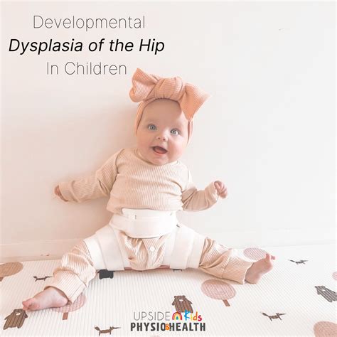 Developmental Dysplasia Of The Hip In Children Upside Kids Physio