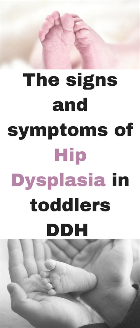 The Signs And Symptoms Of Hip Dysplasia In Toddlers Ddh By Emma At Emma