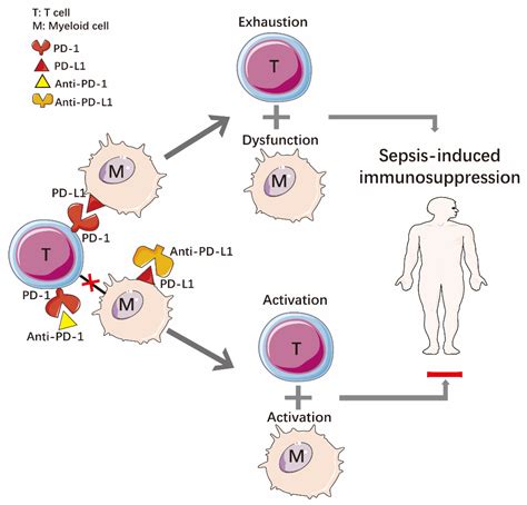 Sepsis Pathophysiology Diagram