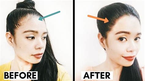 How To Regrow Receding Hairline Female  A Comprehensive Guide