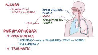 Tension Pneumothorax What Is It Causes Signs Symptoms Diagnosis