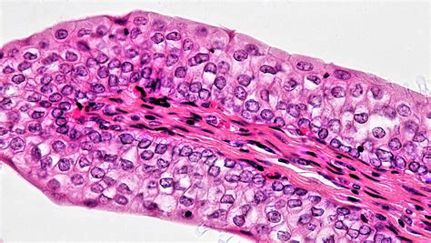 Simple Cuboidal Epithelium Labeled X