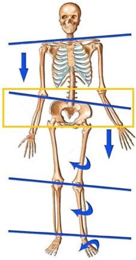 Lateral Tilt Of Pelvis