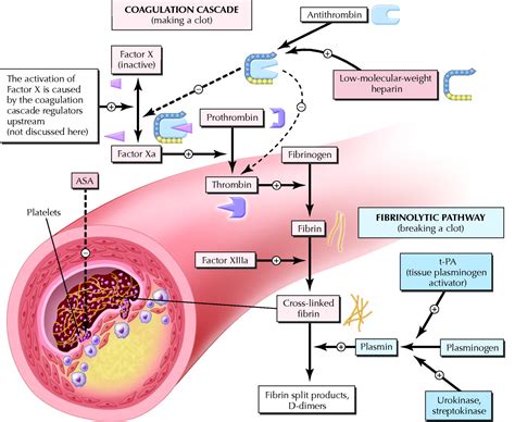 New Advances In The Management Of Acute Coronary Syndromes 4 Low