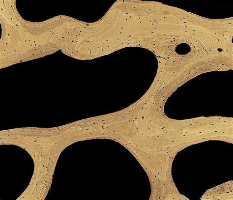 Hope you enjoy and please. Bone Cross-section Photograph by Science Photo Library