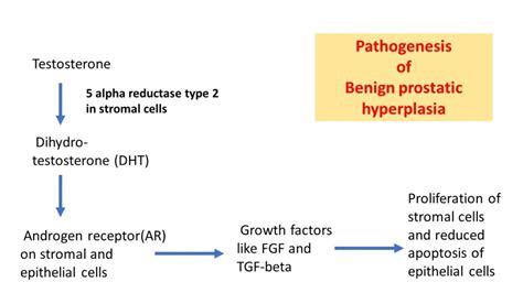 Benign Prostatic Hyperplasia BPH Nodular Hyperplasia Of Prostate