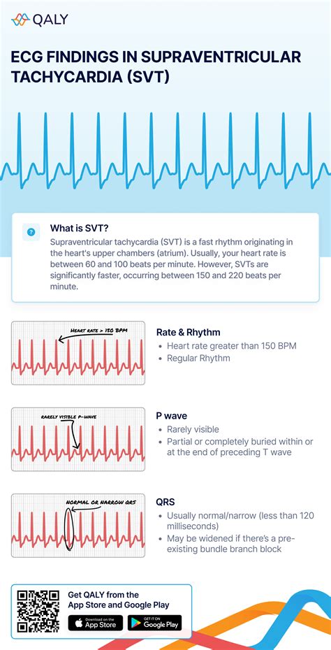 Ventricular Tachycardia Vs Supraventricular Tachycardia