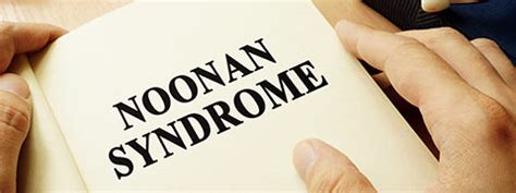 Noonan Syndrome Causes Symptoms And Treatment