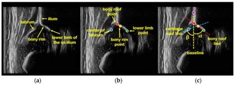 Diagnostics Free Full Text Development Of A Fully Automated Graf