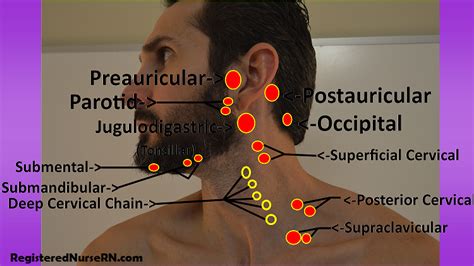 Head And Neck Assessment Nursing