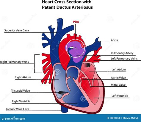 Ductus Arteriosus Ilustración Del Vector Ilustración De Heart 16692354