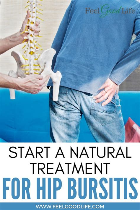 How To Treat Hip Bursitis At Home A Natural Approach In