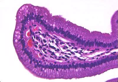 Hepatic Histology Extrahepatic Biliary System