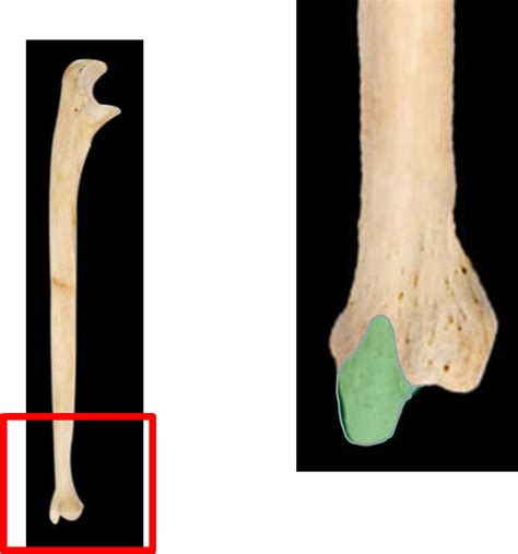 Appendicular Skeleton Upper And Coxal At Auburn University Studyblue