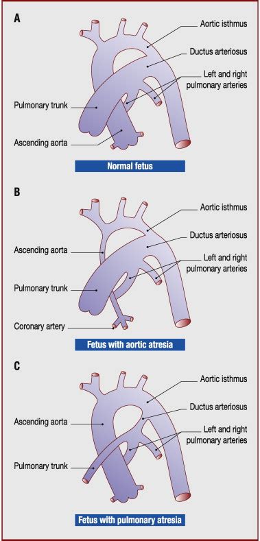 The Ductus Arteriosus Physiology Regulation And Functional And