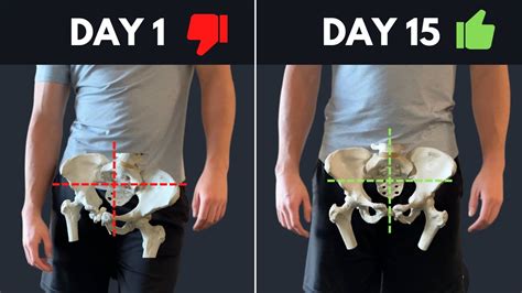 The Best Resource On The Internet For Fixing Lateral Pelvic Tilt