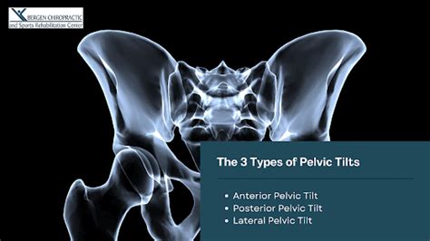 Align Your Life Chiropractic Aid For Pelvic Tilt