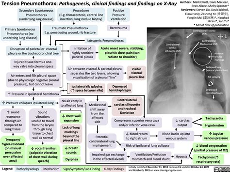 Tension Pneumothorax Calgary Guide