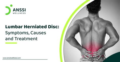 Lumbar Herniated Disc Symptoms Causes And Treatment