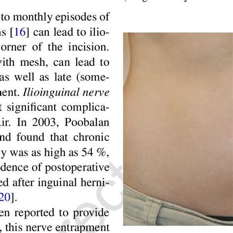 Pdf Ilioinguinal Nerve Entrapment Pelvic